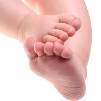 El pie plano de los niños