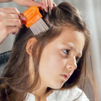 Decálogo contra los piojos de los niños