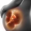 Posiciones de los bebés en el parto múltiple