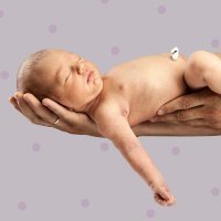 Como+Curar+Un+Nacido El ombligo del recién nacido: ¡Qué engorro!
