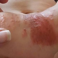 Antes de besar a un bebé... ¡piénsatelo!