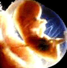 Barriga de aluguel no Brasil