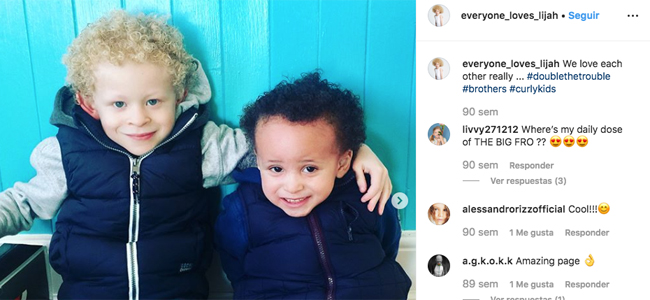 historia de superación de un niño albino