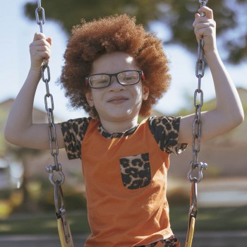 La historia de superación de un niño albino que te conmoverá el alma