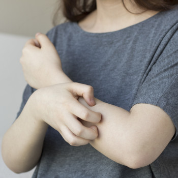 Qué es la enfermedad de Lyme, cómo se contagia y cómo tratarla