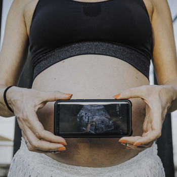 Qué significan las distintas posiciones de la placenta en el embarazo