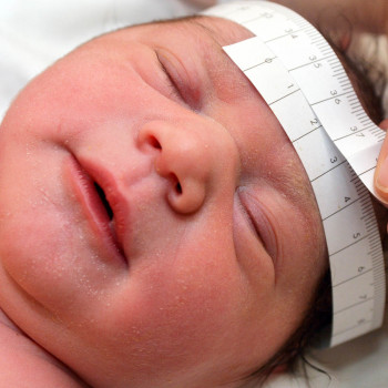 Qué es la hidrocefalia, cómo se detecta y se trata en los niños