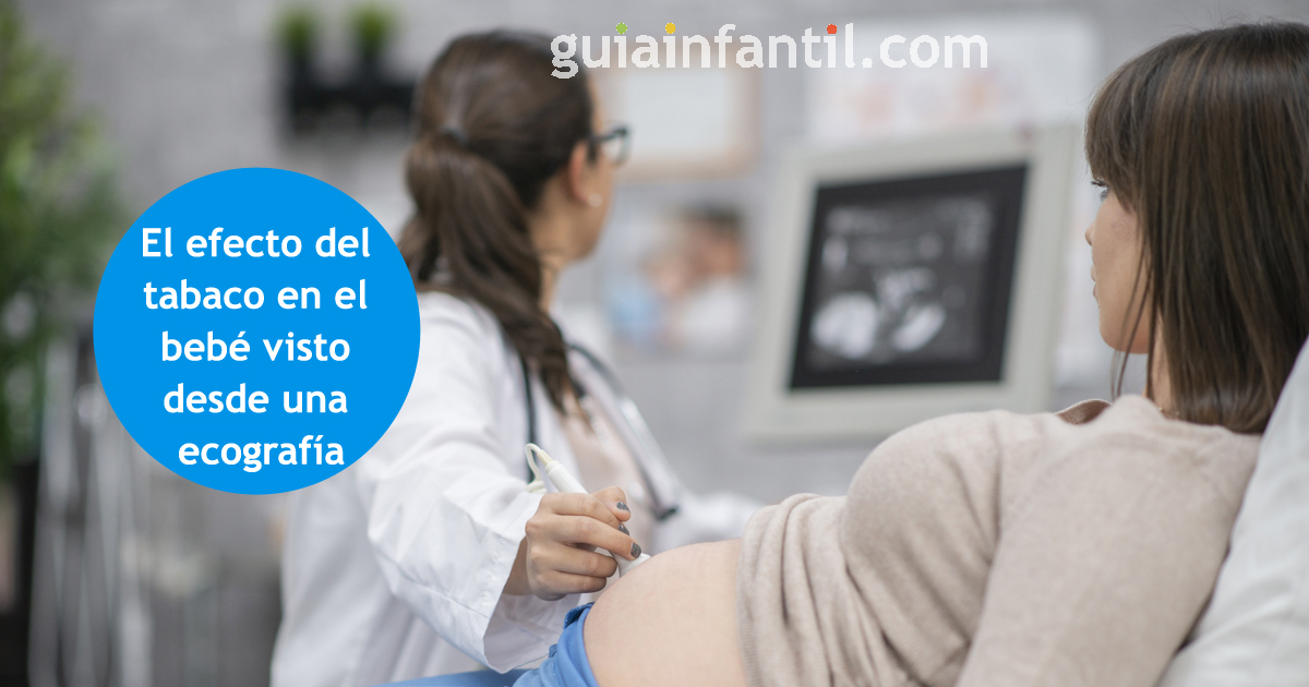 efecto del humo en el bebé 