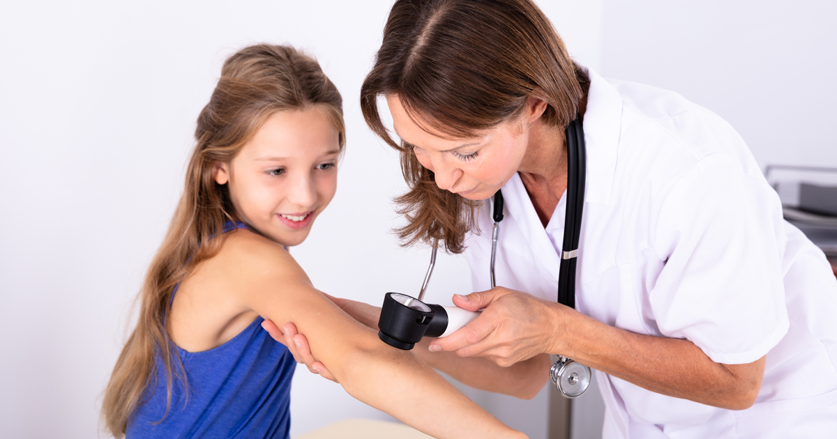 lunares en los niños cáncer de piel