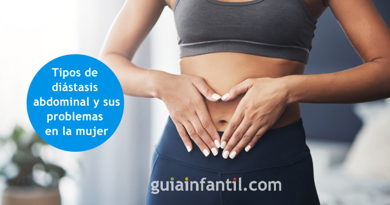 Cómo saber si tengo Diástasis abdominal? ⋆ Fisio Fit Mujer