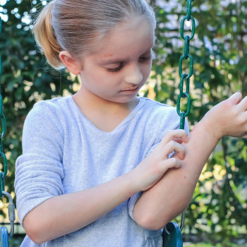Las alergias en niños aumentan por pasar mucho tiempo en casa
