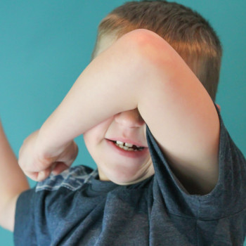 Síndrome de Williams en niños. Síntomas, tratamiento y diagnóstico