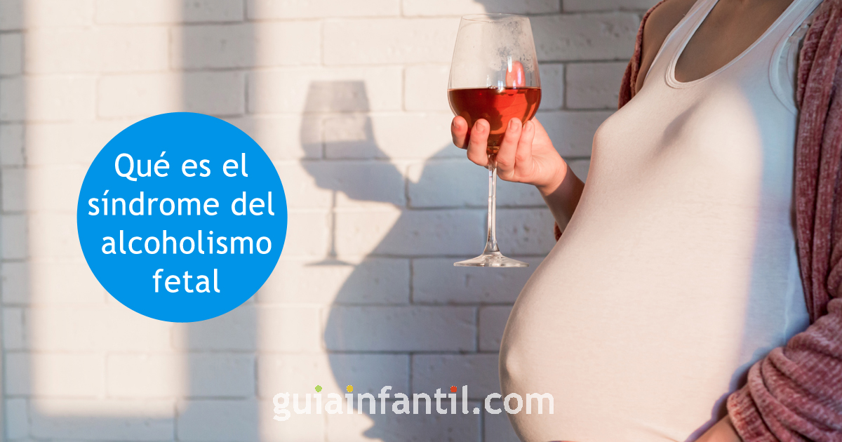 síndrome del alcoholismo fetal