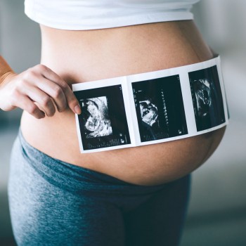 9 pruebas diagnósticas en el embarazo para detectar anomalías en el feto