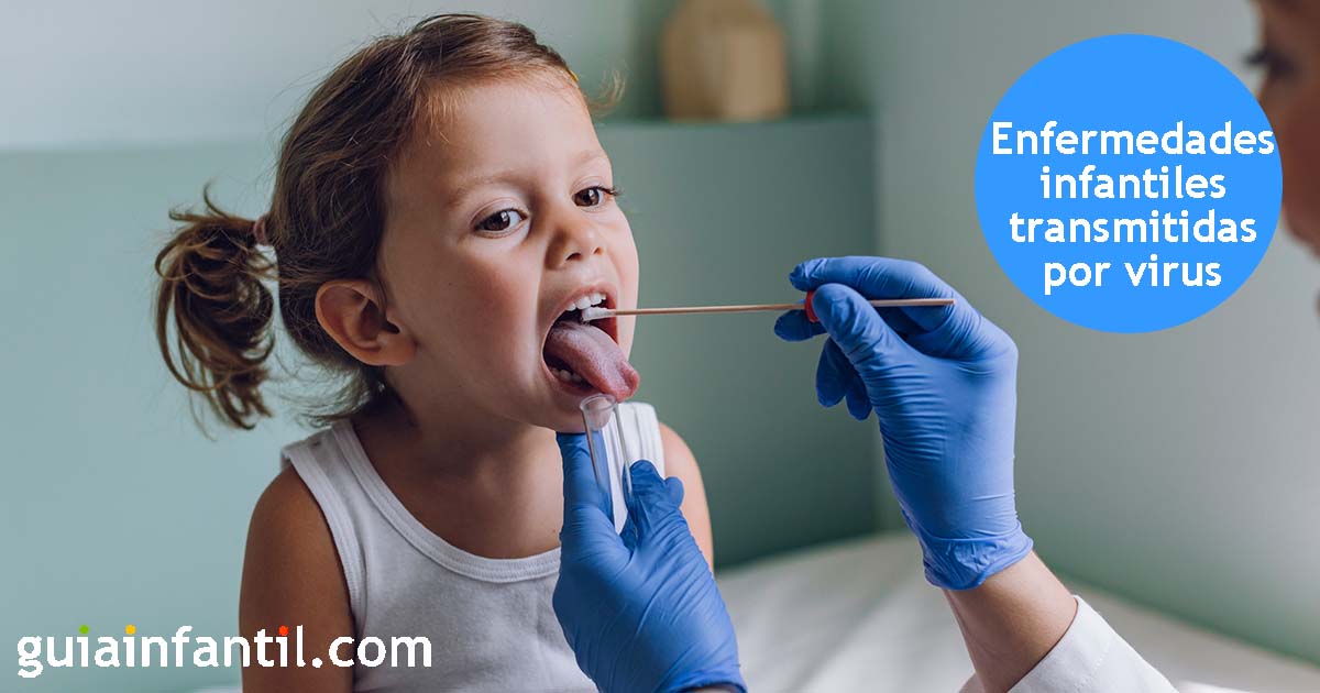 enfermedades víricas en bebés y niños