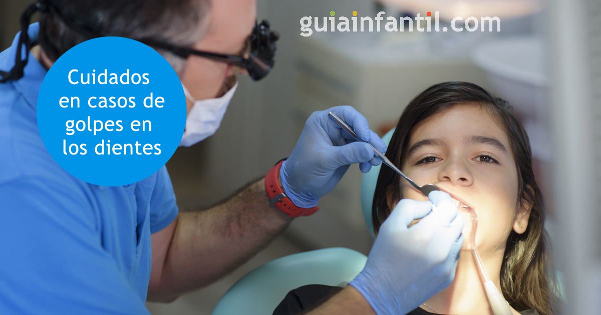 cuidados para traumatismo dentales