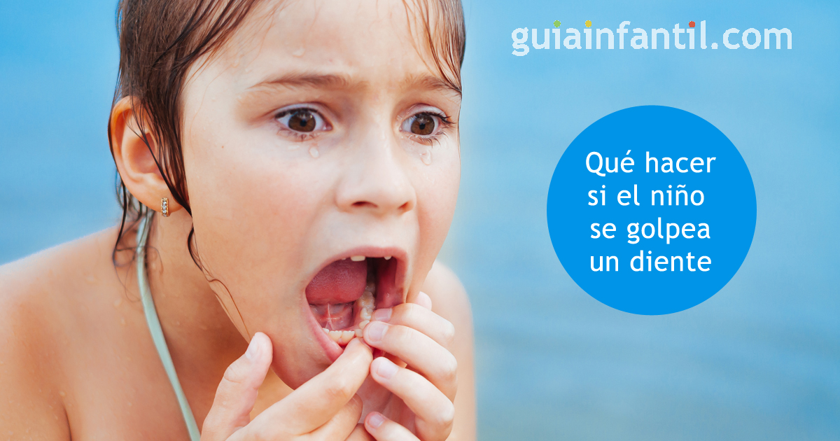 golpes en los dientes
