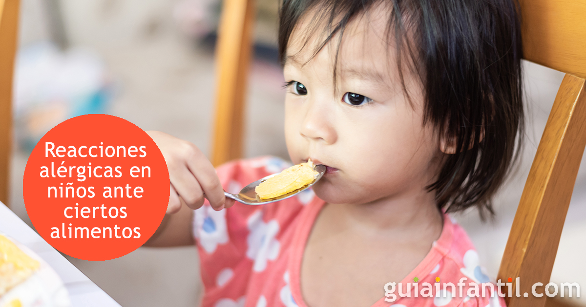 Las reacciones alérgicas en tu hijo