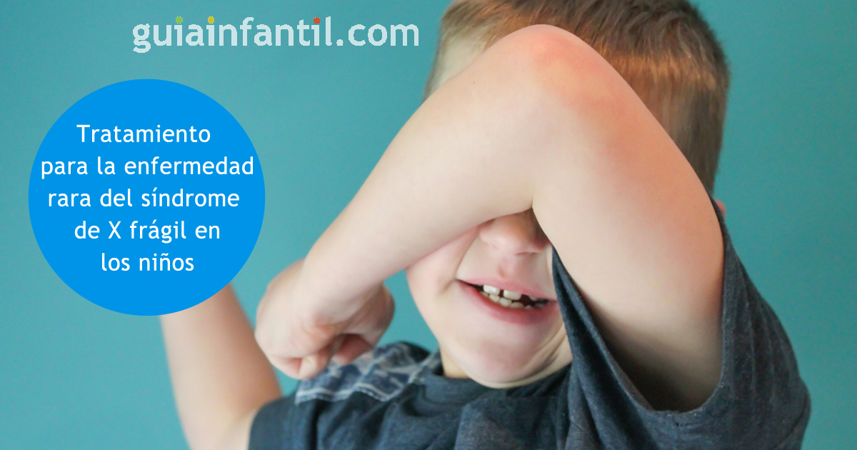 Tratamiento del síndrome X de frágil en niños
