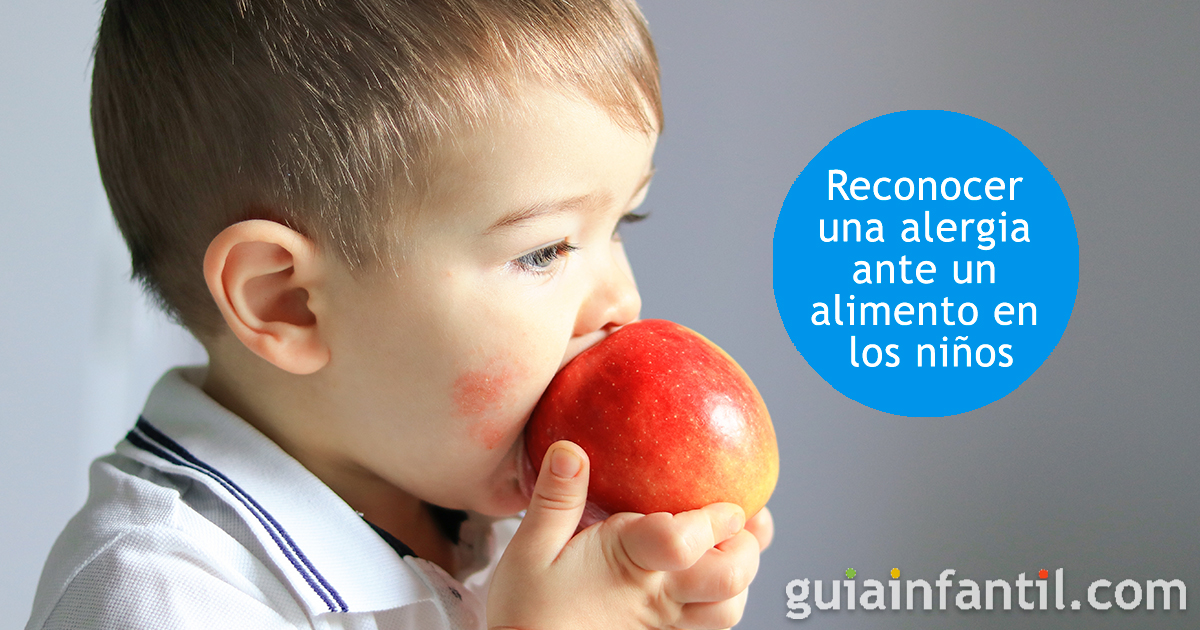 Las alergias alimentarias de los niños