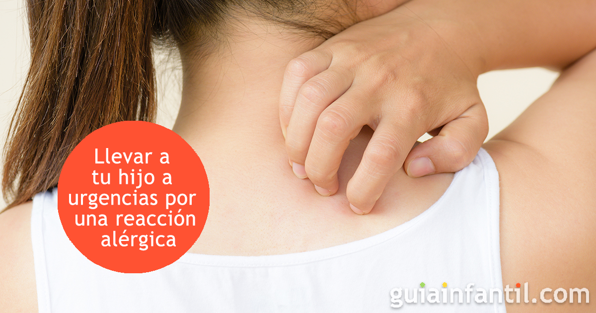 Llevar a un niño a urgencias ante una reacción alérgicas