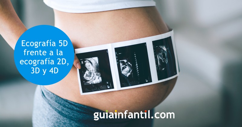 La emocionante imagen de tu bebé con la ecografía en 5D