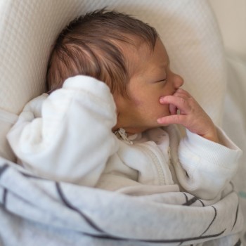 Síndrome Prader-Willi en niños. Enfermedad rara del sistema endocrino