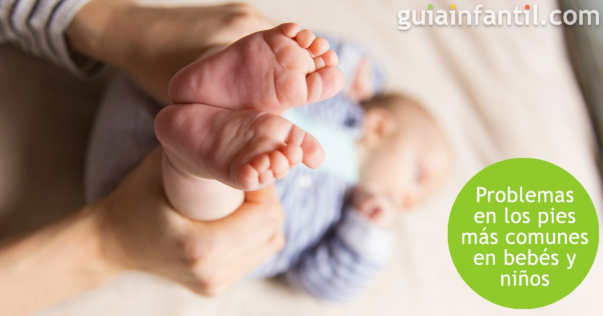 Problemas en los pies de los niños