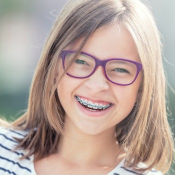 La edad más recomendada para ponerles brackets a los niños