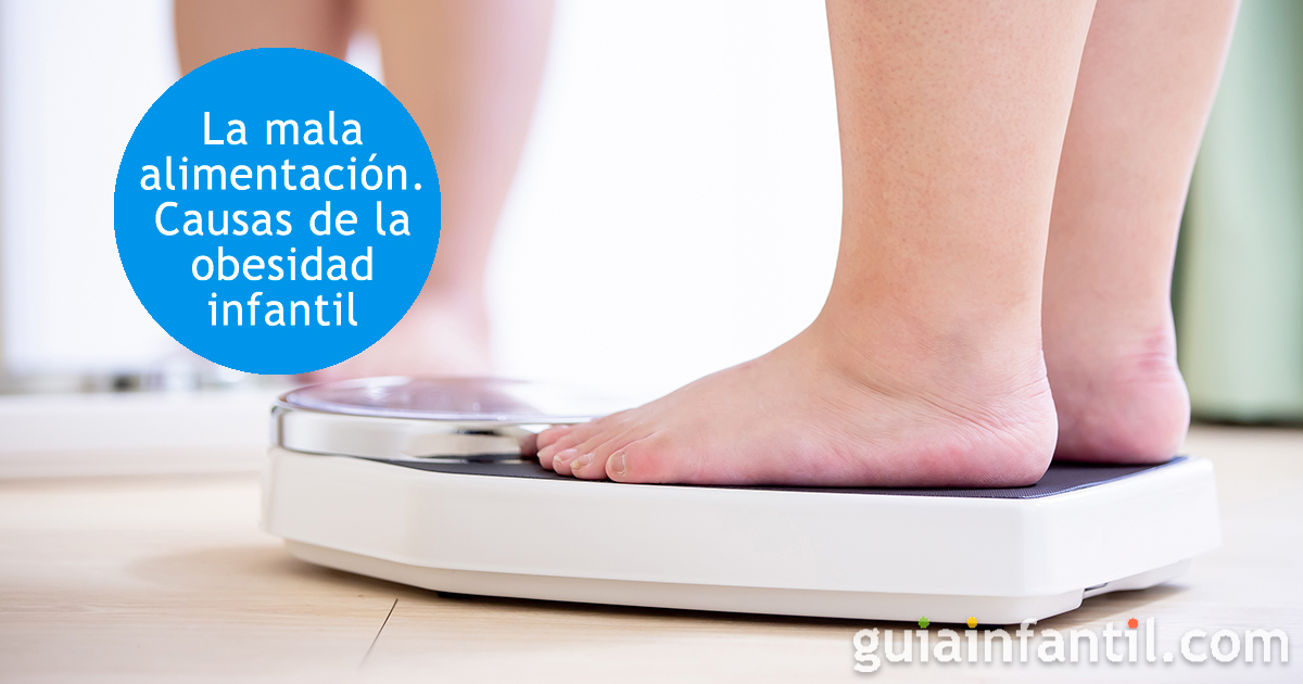 Causas de la obesidad infantil