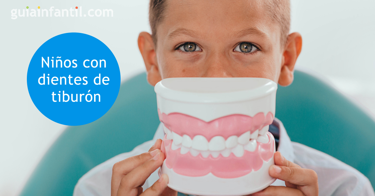 niños con dientes de tiburón