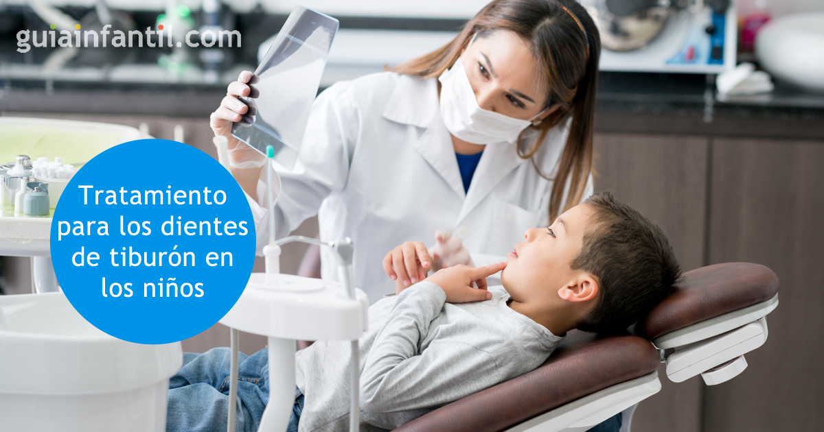 los niños con dientes de tiburón