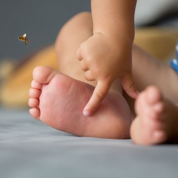 Qué hacer si al niño le pica una abeja o una avispa