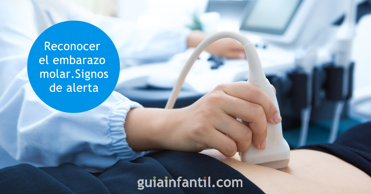 signos de alerta en el embarazo molar