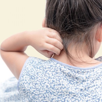 Causas y tratamiento de la Psoriasis en niños