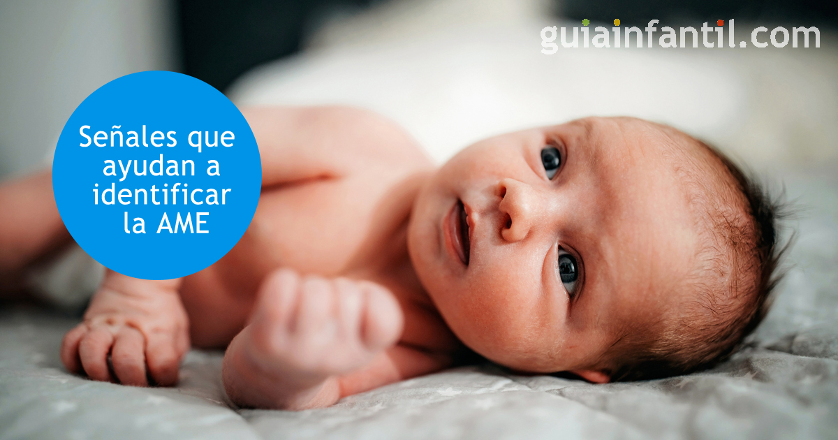 AME en niños