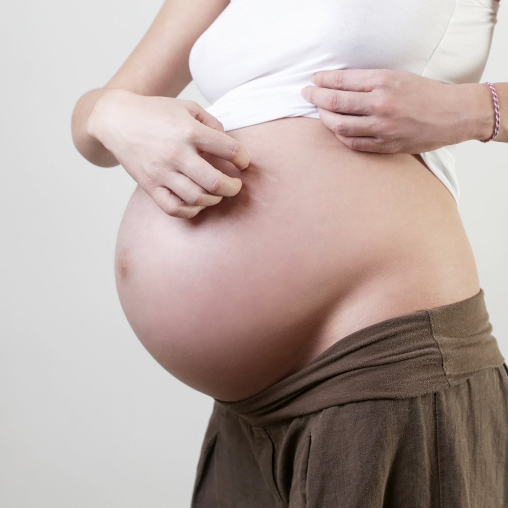 12 remedios caseros para aliviar los picores en el embarazo
