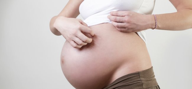 12 remedios caseros para aliviar los picores en el embarazo