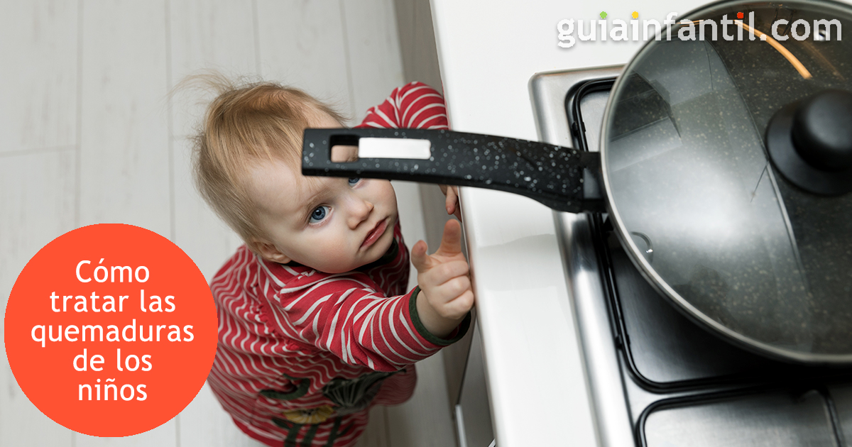 Tratar una quemadura en los niños