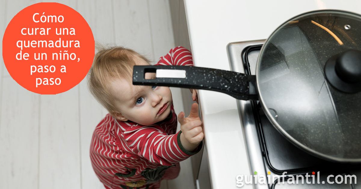 Cuando los niños tienen quemaduras