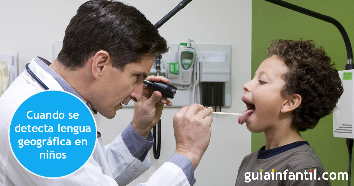 síntomas de la lengua geográfica en niños