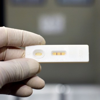 Hormona del embarazo ¿cómo y cuándo se detecta? - Funciones de la hCG
