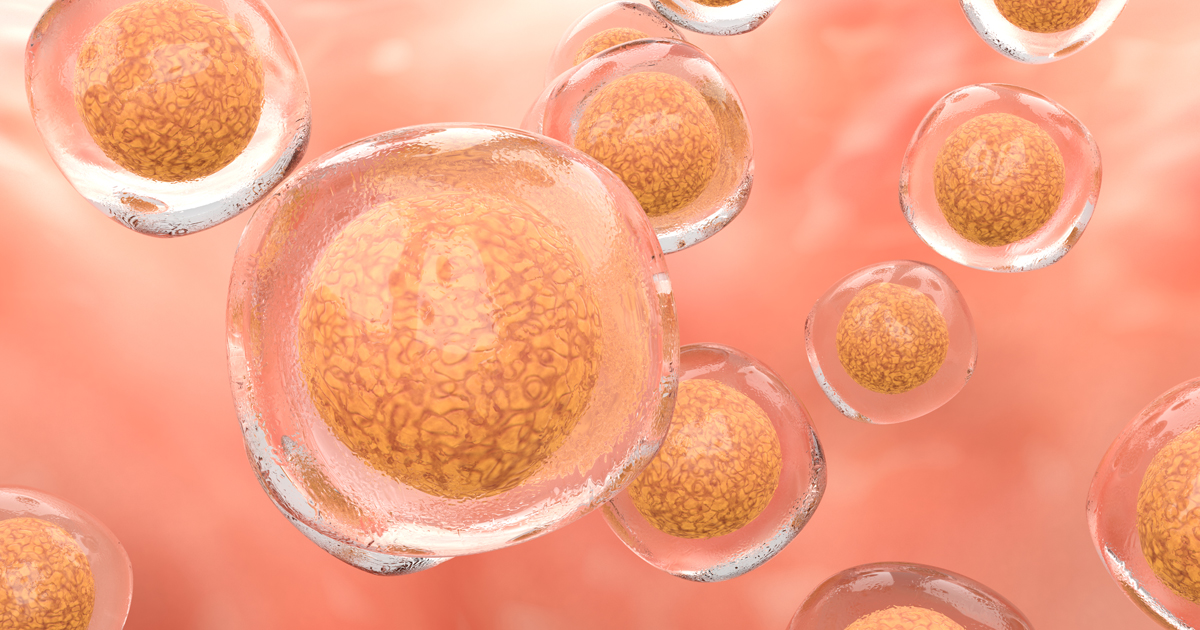 Síntomas de la anaovulación