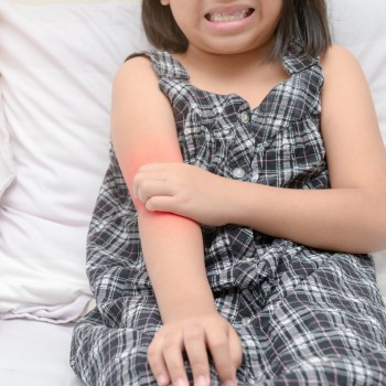 Las 7 enfermedades e infecciones de la piel más comunes en niños