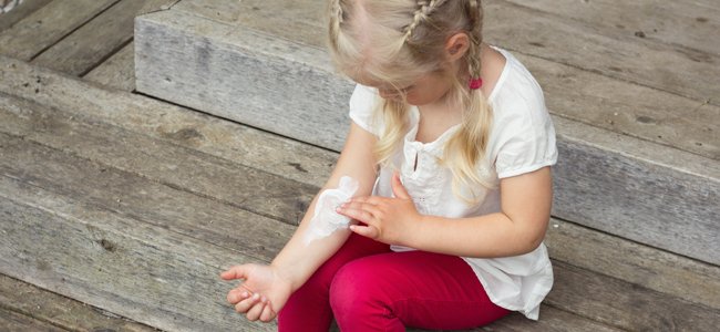Cómo afecta la dermatitis atópica en la autoestima de los niños