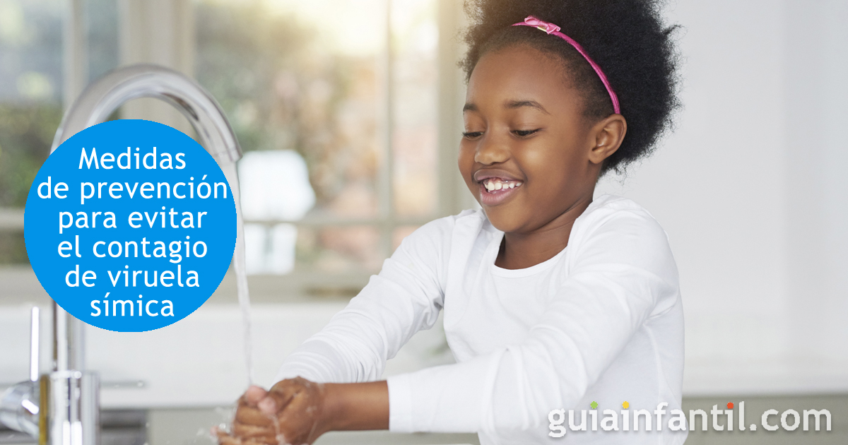 Medidas de prevención para evitar el contagio de viruela símica