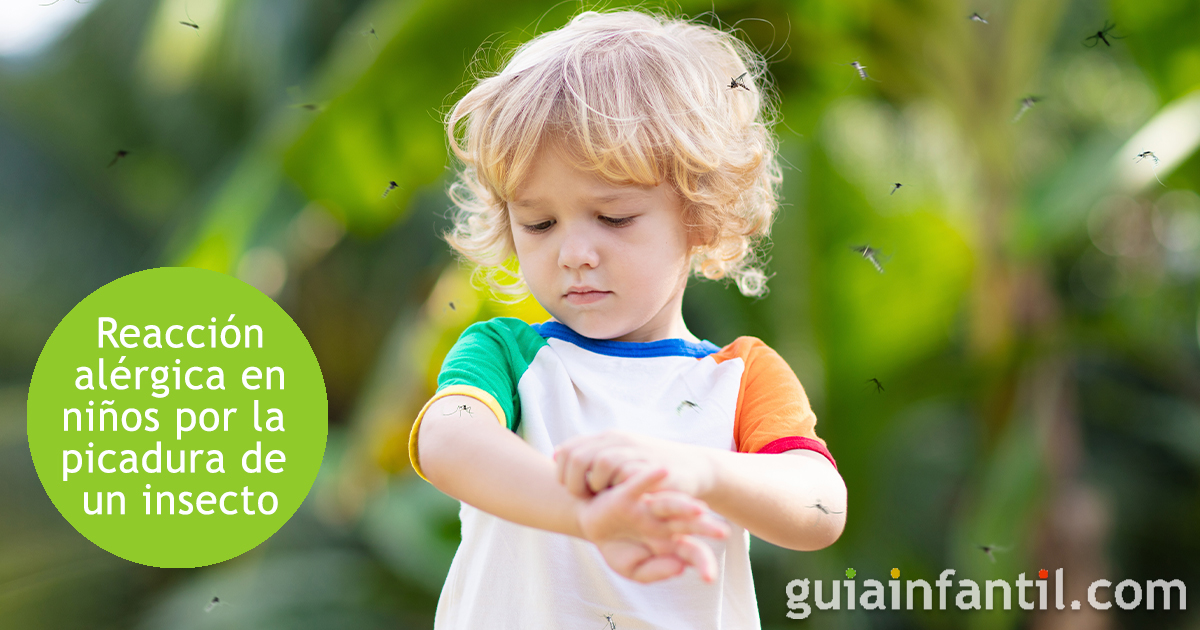 Picaduras de insectos que causan reacciones alérgicas
