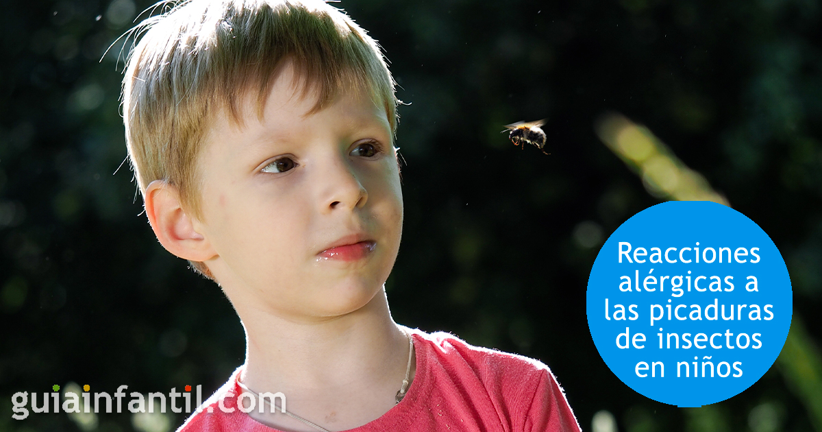 Alergia a los mosquitos en niños