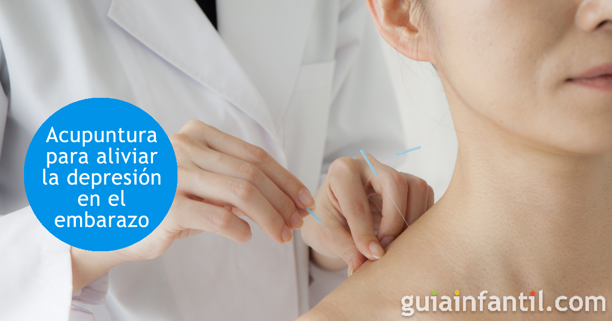 Acupuntura para aliviar la depresión en el embarazo
