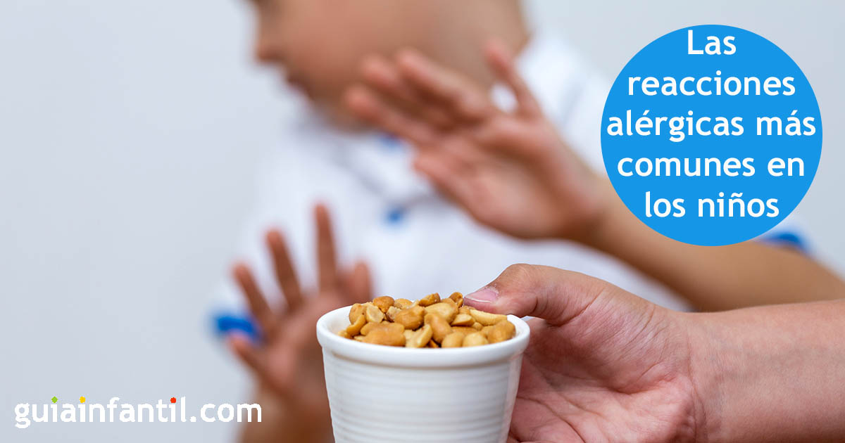 alergias infantiles